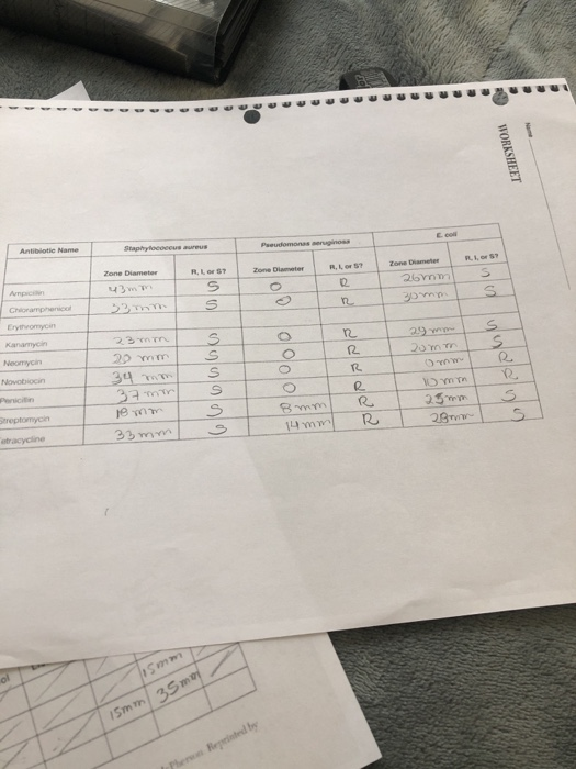 sou UUUUUUUUUUUUU WORKSHEET Pseudomonas Antibiotie Name Zone Diameter Zone Damer R. Zone Damer 26mm om Ampician Choramphenico