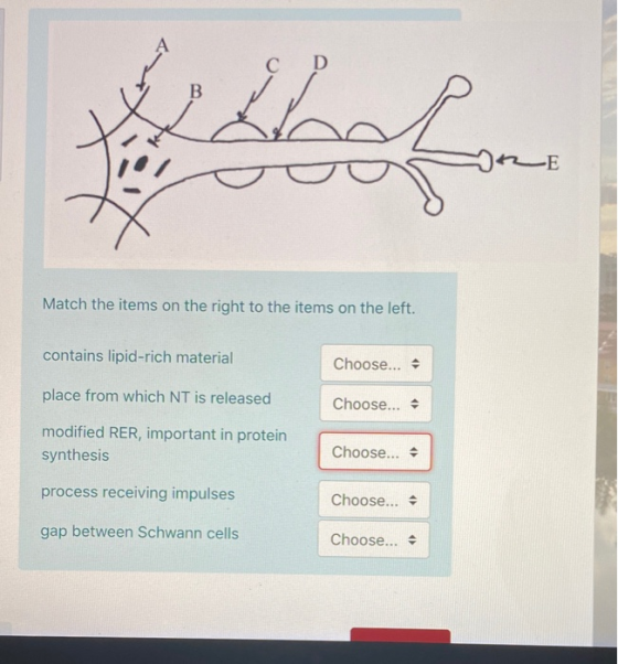 ZE Match the items on the right to the items on the left. contains lipid-rich material Choose... - place from which NT is rel