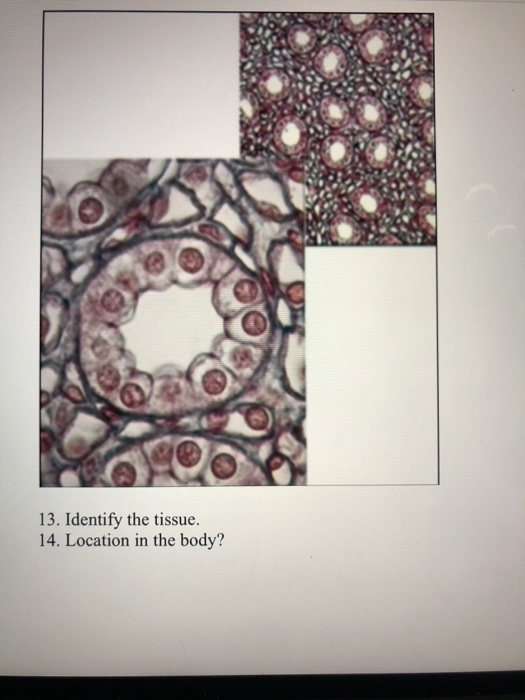 13. Identify the tissue. 14. Location in the body?