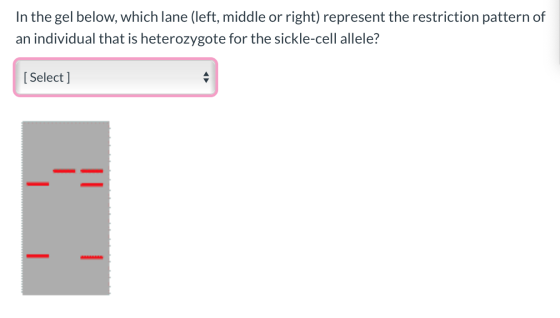 In the gel below, which lane (left, middle or right) represent the restriction pattern of an individual that is heterozygote