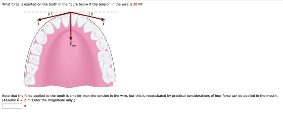 What force is exerted on the tooth in the figure below if the tension in the wire is 20 N? Ja Fupp » Note that the force appl