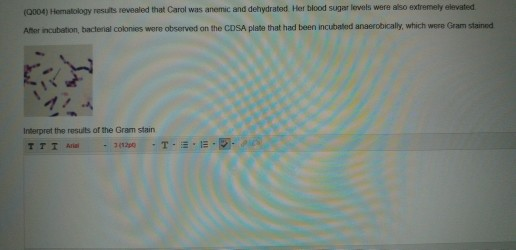 (0004) Hematology resuits revealed that Carol was anemic and dehydrated Her blood sugar levels were also extremely elevatesd