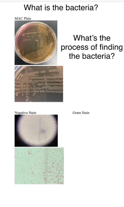 What is the bacteria? MAC Plate Whats the process of finding the bacteria? Negative Stain Gram Stain