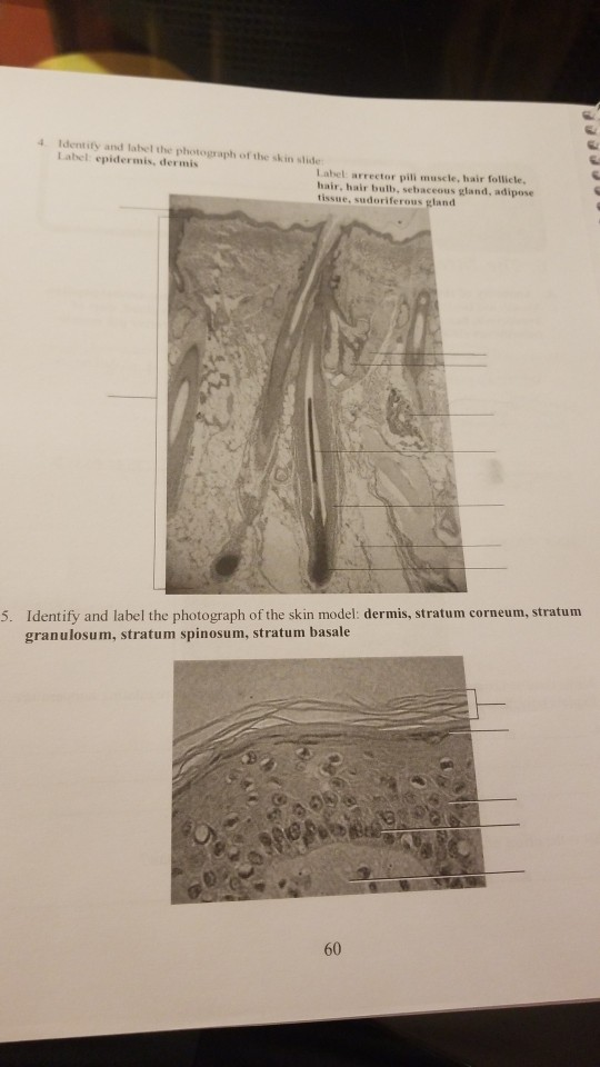 4 Identity and label the photograph of the skin slider Label epidermis, dermis Label arrector pill muscle, hair follicle. hai