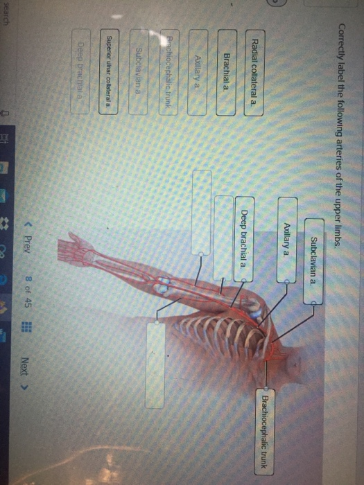 Correctly label the following arteries of the upper limbs. Subclaviana. Axillary a. Brachiocephalic trunk Radial collateral a