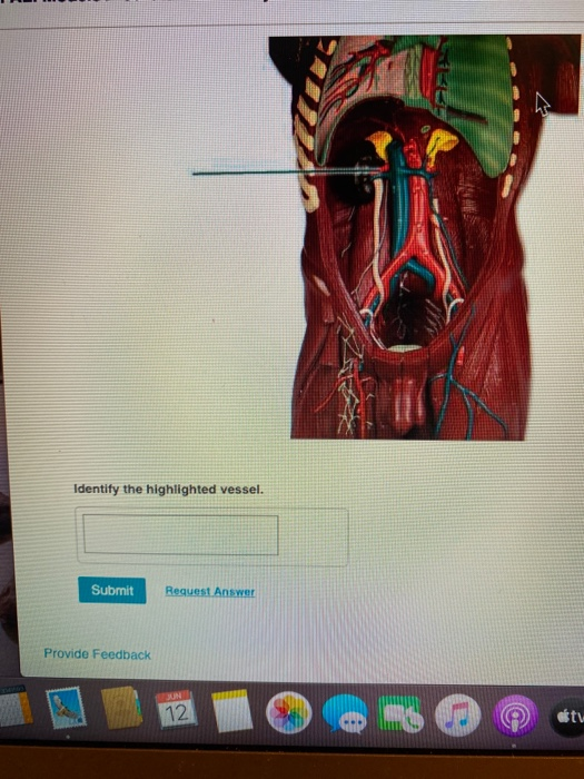 Identify the highlighted vessel. Submit Request Answer Provide Feedback UN 12 tv