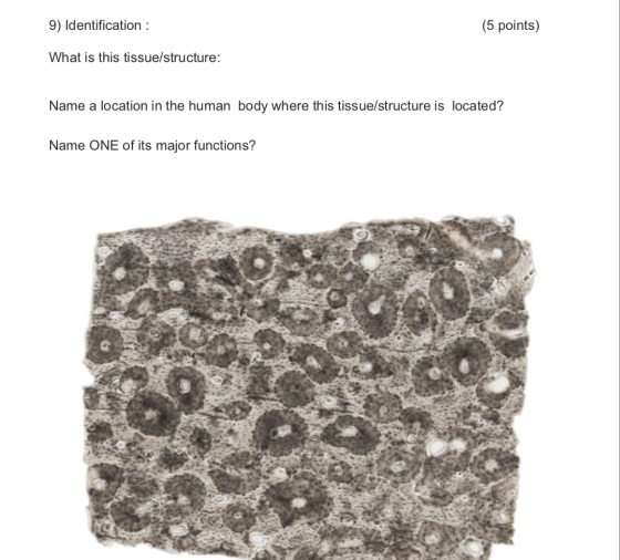 9) Identification : (5 points) What is this tissue/structure: Name a location in the human body where this tissue/structure i