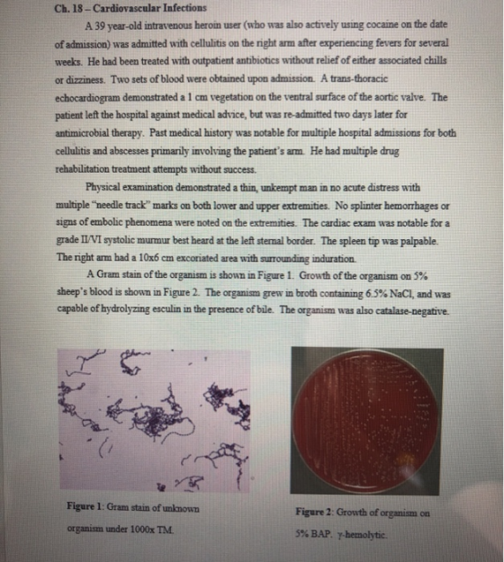 Ch. 18-Cardiovascular Infections A 39 year-old intravenous heroin user (who was also actively using cocaine on the date of ad