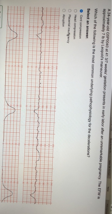 A 24-year-old G5P0040 at 41 3/7 weeks gestation presents in early labor after an unremarkable pregnancy. The EFW is approxim