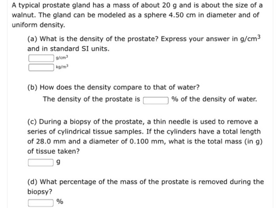 A typical prostate gland has a mass of about 20 g