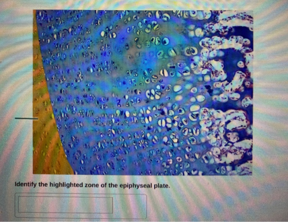 M ASD dle 3 Identify the highlighted zone of the epiphyseal plate.