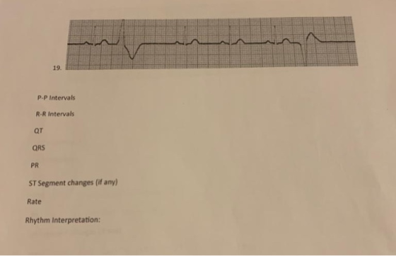 19. P-P Intervals R-R Intervals QT QRS PR ST Segment changes (if any) Rate Rhythm Interpretation: