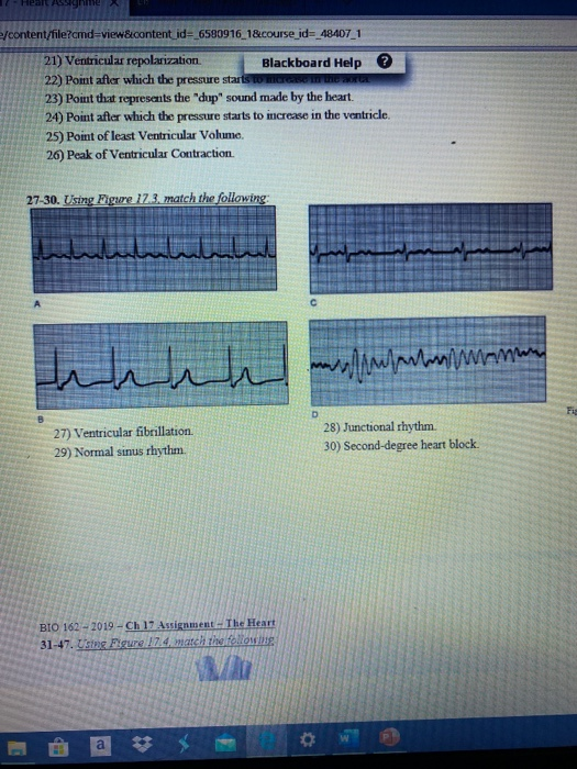 Heart A nne /content/file?cmd=view&content_id=_6580916_1&course_id=_48407_1 21) Ventricular repolarization Blackboard Help ?