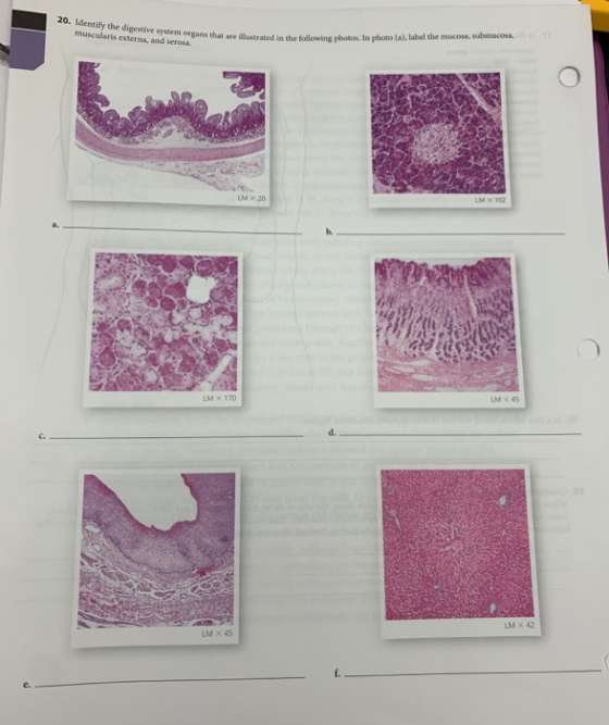 20. Identify the digestive system organs that muscularis extern a ularis externa, and serosa em organs that are illustrated i