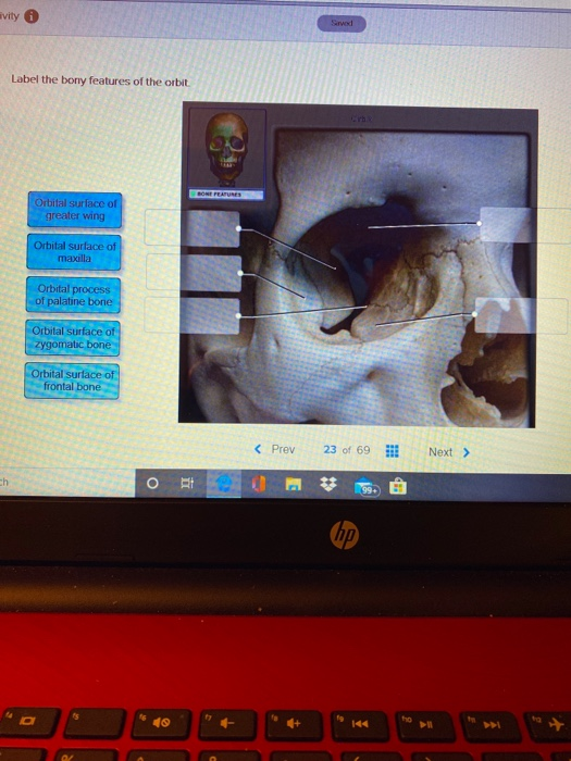 avity Sred Label the bony features of the orbit Orbital surface of greater wing Orbital surface of maxilla Orbital process of