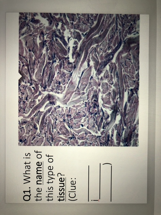 Q1. What is the name of this type of tissue? (Clue: