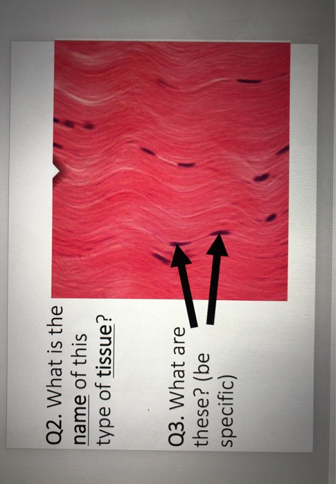 Q2. What is the name of this type of tissue? Q3. What are these? (be specific)