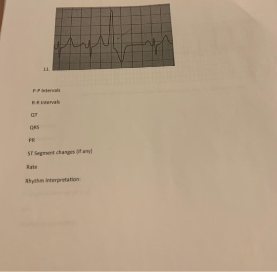 P-P Intervals R-R Intervals QT QRS PR ST Segment changes (if any) Rate Rhythm Interpretation: