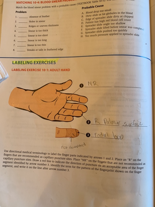 Match! Problem Holes in smear MATCHING 10-4: BLOOD SMEAR PRUDLUM atch the blood smear problem with a probable cause TEXTBOOK