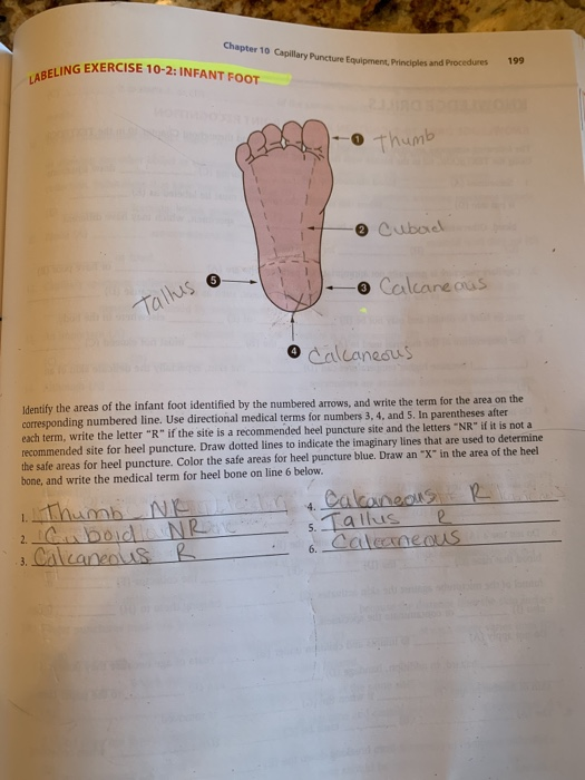 Chapter 10 Capillary Puncture f ING EXERCISE 10-2: INFANT FOOT ary Puncture C oment. Principles and Procedures oment. Prin LA