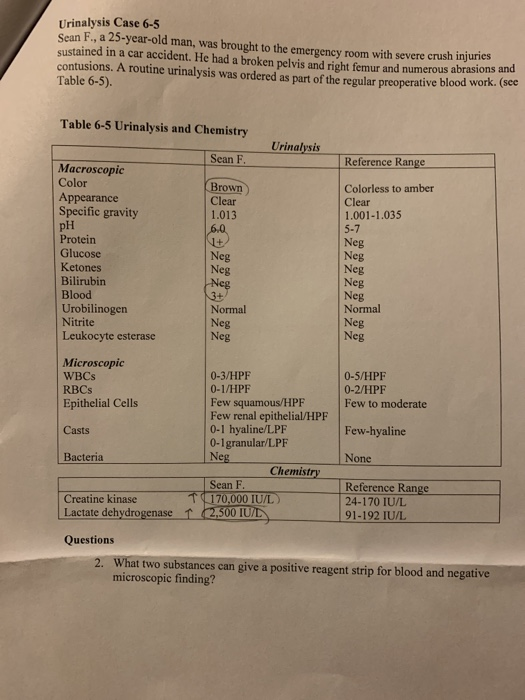 Urinalysis Case 6-5 Sean F., a 25-year-old man, was brought to the emergency room with severe crush injuries sustained in a c