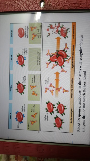 TYPE B TYPE AB TYPE O Surface Surloce antigen B anfigen A antigen A and B surface antigens Anti B Neither anti A nor Ant-A and Surfoce antigen B Blood Response: antibodies in the plasma will recognize foreign antigens that do not match the host blood