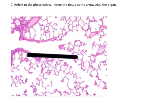 7. Refers to the photo below. Name the tissue at the arrow AND the organ.