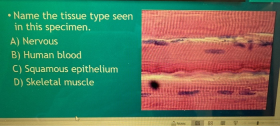 • Name the tissue type seen in this specimen. A) Nervous B) Human blood C) Squamous epithelium D) Skeletal muscle
