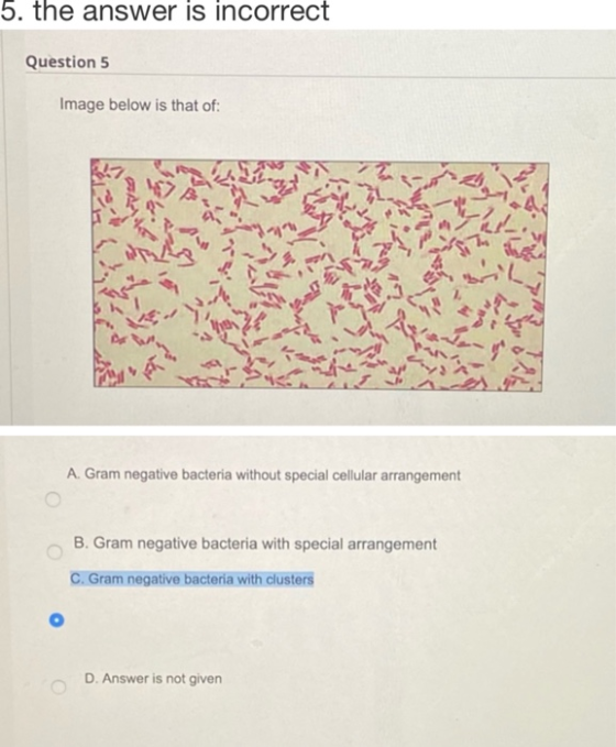 5. the answer is incorrect Question 5 Image below is that of: A. Gram negative bacteria without special cellular arrangement