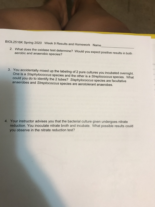 BIOL2516K Spring 2020 Week 9 Results and Homework Name 2. What does the oxidase test determine? Would you expect positive res