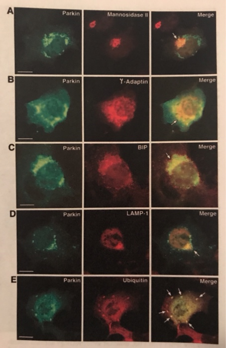 Parkin Mannosidase II Merge Parkin Y-Adaptin Merge Parkin BIP Merge Parkin LAMP-1 Merge Parkin Ubiquitin Merge