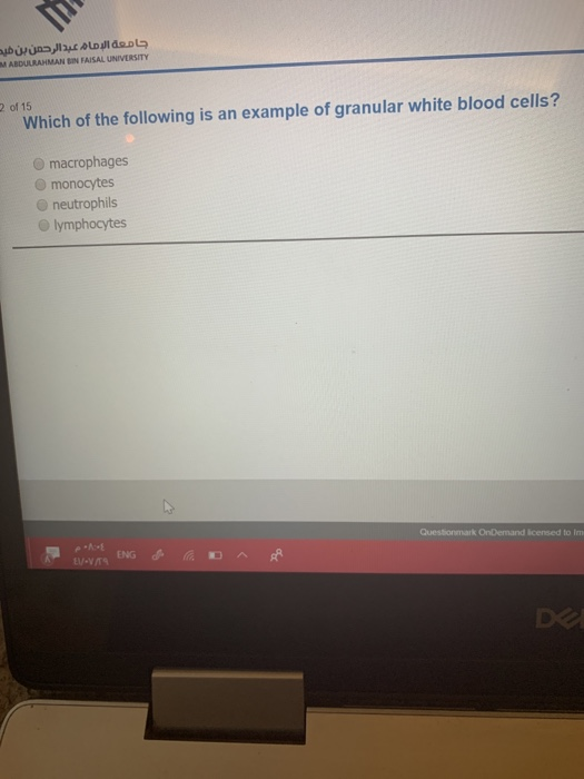 جامعة الإمام عبد الرحمن بن هي ABDULRAHMAN BIN FAISAL UNIVERSITY 2 of 15 Which of the following is an example of granular whit