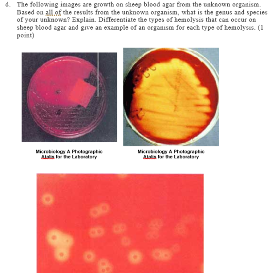 d. The following images are growth on sheep blood agar from the unknown organism Based on all of the results from the unknown