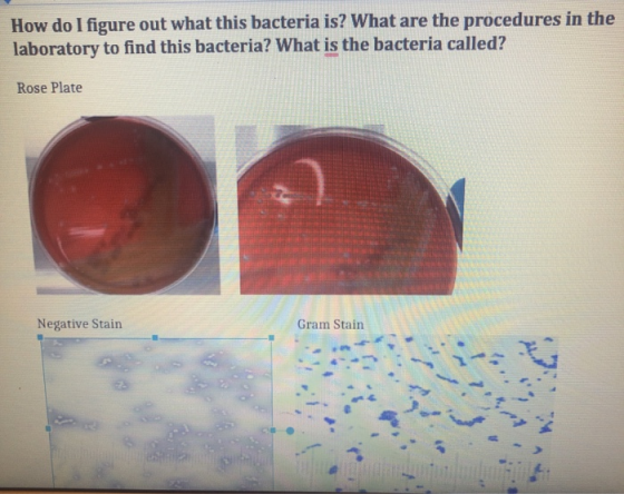 How do I figure out what this bacteria is? What are the procedures in the laboratory to find this bacteria? What is the bacte