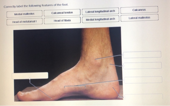 Correctly label the following features of the foot. Medial malleolus Calcaneal tendon Lateral longitudinal arch Calcaneus Hea
