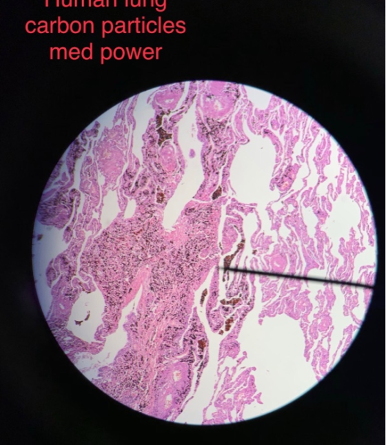 carbon particles med power