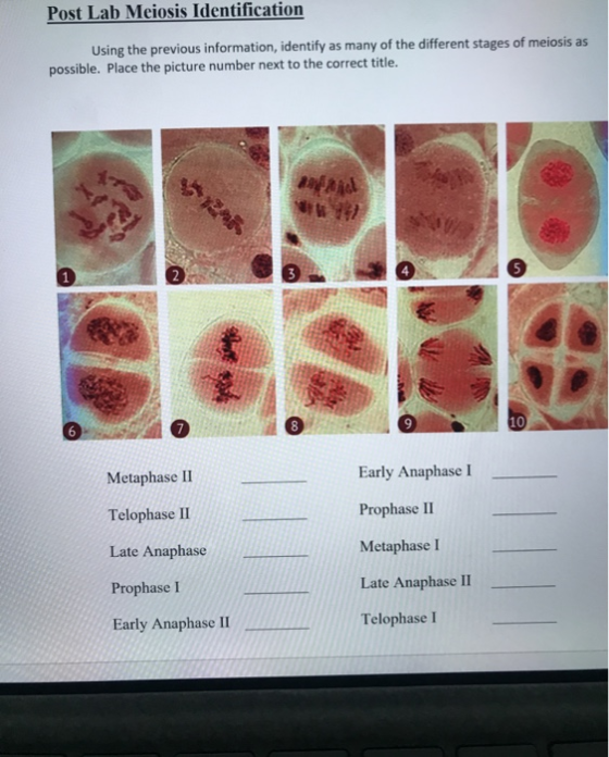 Post Lab Meiosis Identification Using the previous information, identify as many of the different stages of meiosis as possib