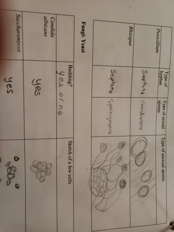 Type of hyphae Penicillium Type of sexual spores Type of asexual spores Septate conidiospore Rhizopus Septate sporang ospore