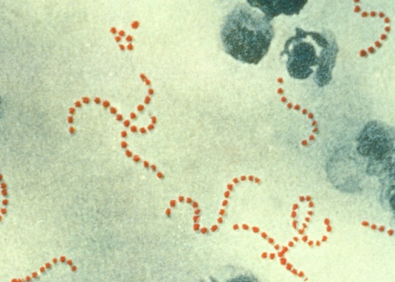 Streptococcus_pyogenes.jpg