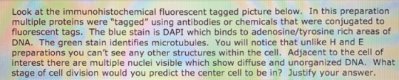 Look at the immunohistochemical fluorescent tagged picture below. In this preparation multiple proteins were tagged using antibodies or chemicals that were conjugated to fluorescent tags. The blue stain is DAPI which binds to adenosine/tyrosine rich areas of DNA. The green stain identifies microtubules. You will notice that unlike H and E preparations you cant see any other structures within the cell. Adjacent to the cell of interest there are multiple nuclei visible which show diffuse and unorganized DNA. What stage of cell division would you predict the center cell to be in? Justify your answer.