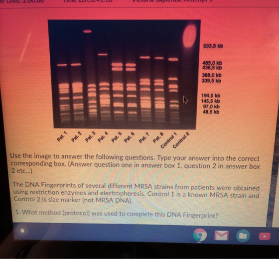 533,5 kb 485,0 kb 436,5 kb 388,0 kb 339,5 kb 194,0 kb 145,5 kb 97,0 kb 48,5 kb i Control 1 Use the image to answer the follow