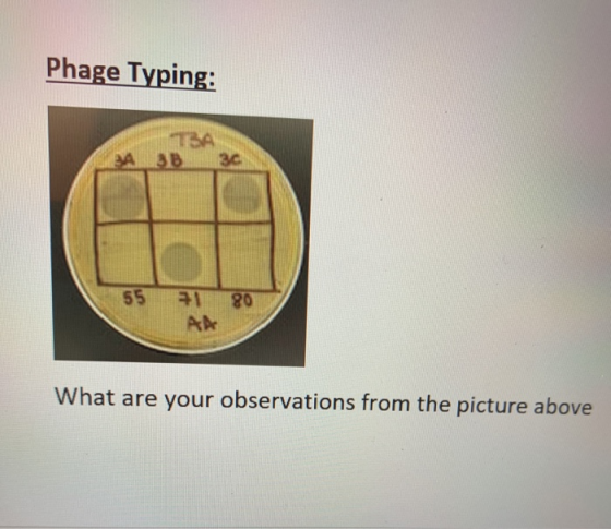 Phage Typing: ASB 55 1 80 What are your observations from the picture above