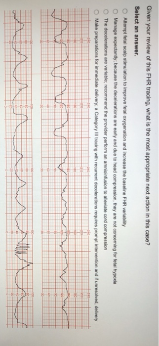 Given your review of this FHR tracing, what is the most appropriate next action in this case? Select an answer. O O O Attempt