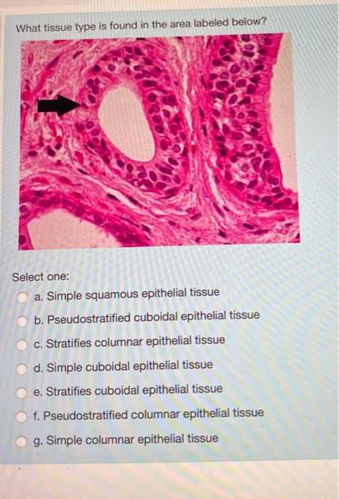 What tissue type is found in the area labeled below? Select one: a. Simple squamous epithelial tissue b. Pseudostratified cub