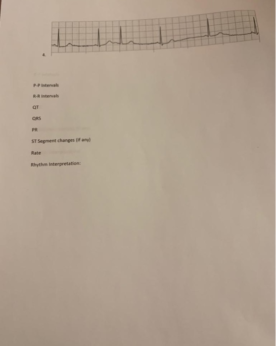 P-P Intervals R-R Intervals QT QRS PR ST Segment changes (if any) Rate Rhythm Interpretation: