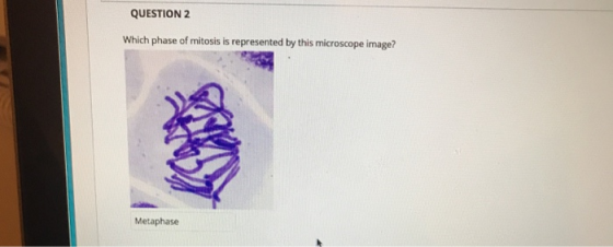 QUESTION 2 Which phase of mitosis is represented by this microscope image? Metaphase