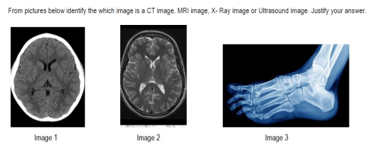From pictures below identify the which image is a CT image, MRI image, X-Ray image or Ultrasound image. Justify your answer.