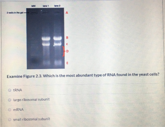MW tane 1 lane 2 3 welis in the pe Examine Figure 2.3. Which is the most abundant type of RNA found in the yeast cells? tRNA