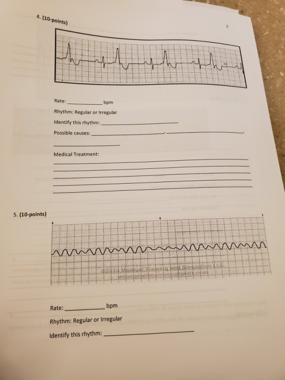 4. (10-points) Rate: bpm Rhythm: Regular or Irregular Identify this rhythm: Possible causes: Medical Treatment: 5. (10-points