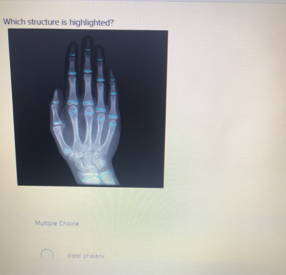 Which structure is highlighted? Multiple Choice distal phalanx